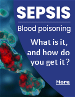Sepsis is a life-threatening illness that occurs when the bodys immune system attacks its very own tissues and organs in response to infection. Sepsis is caused by inflammation (swelling) throughout the body. During Sepsis, inflammation and blood clotting restrict blood flow to limbs and essential organs, which can lead to organ failure and death.
